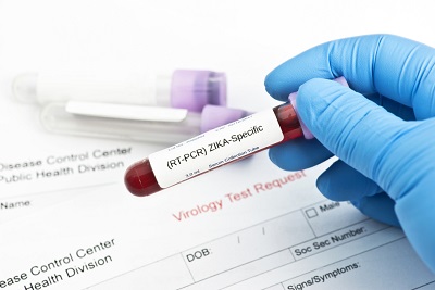 Zika virus RT PCR lab test